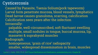 Cysticercosis
Caused by Parasite, Taenia Solium(pork tapeworm)
Larval form penetrate mucosa, blood vessels, lymphatics
Dead larvae causes granuloma, scarring, calcification
Calcification seen years after the infection
Intraorally:
palpable, well-circumscribed, soft fluctuant swelling
multiple, small nodules in tongue, buccal mucosa, lip,
masseter & suprahyoid muscles
Radiograph:
homogeneous, ‘grain of rice’ radiopacity
smaller, widespread dissemination in brain, muscles
Laurie C. Carter, DDS, Ph.D, Soft Tissue Calcifications and Ossifications, pocketdentistry.com, Chapter 28
 