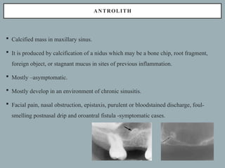 SOFT TISSUE CALCIFICATIONS.pptx ( oral medicine and Radiology) | PPTX