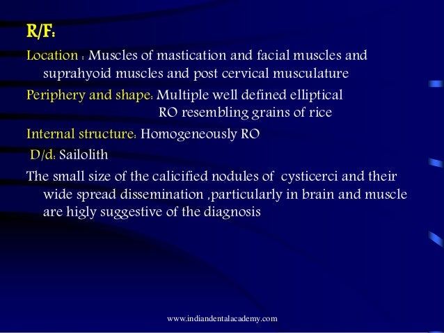 Anal insertions painful video Synonym + facial tissue