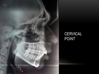 CERVICAL
POINT

 