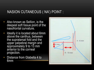 NASION CUTANEOUS ( NA’) POINT :
• Also known as Sellion, is the
deepest soft tissue point of the
nasofrontal curvature.
• Ideally it is located about 6mm
above the canthus, between
the supratarsal fold and the
upper palpebral margin and
approximately 9 to 13 mm
anterior to the corneal
projection.
• Distance from Glabella 4 to
6mm

 