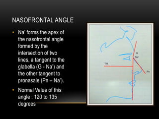 NASOFRONTAL ANGLE
• Na’ forms the apex of
the nasofrontal angle
formed by the
intersection of two
lines, a tangent to the
glabella (G - Na’) and
the other tangent to
pronasale (Pn – Na’).
• Normal Value of this
angle : 120 to 135
degrees

 