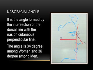NASOFACIAL ANGLE

It is the angle formed by
the intersection of the
dorsal line with the
nasion cutaneous
perpendicular line.
The angle is 34 degree
among Women and 36
degree among Men.

 