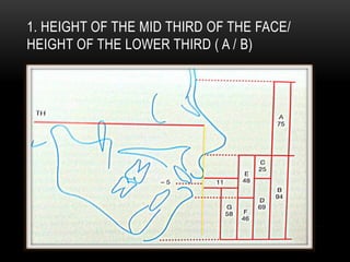 1. HEIGHT OF THE MID THIRD OF THE FACE/
HEIGHT OF THE LOWER THIRD ( A / B)

 