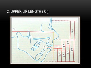 2. UPPER LIP LENGTH ( C )

 