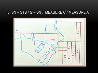 5. SN – STS / G – SN , MEASURE C / MEASURE A

 