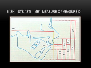 6. SN – STS / STI – ME’ , MEASURE C / MEASURE D

 