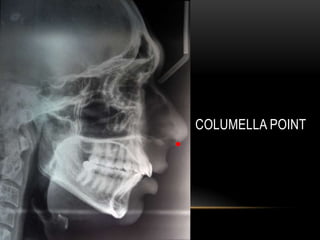 COLUMELLA POINT

 
