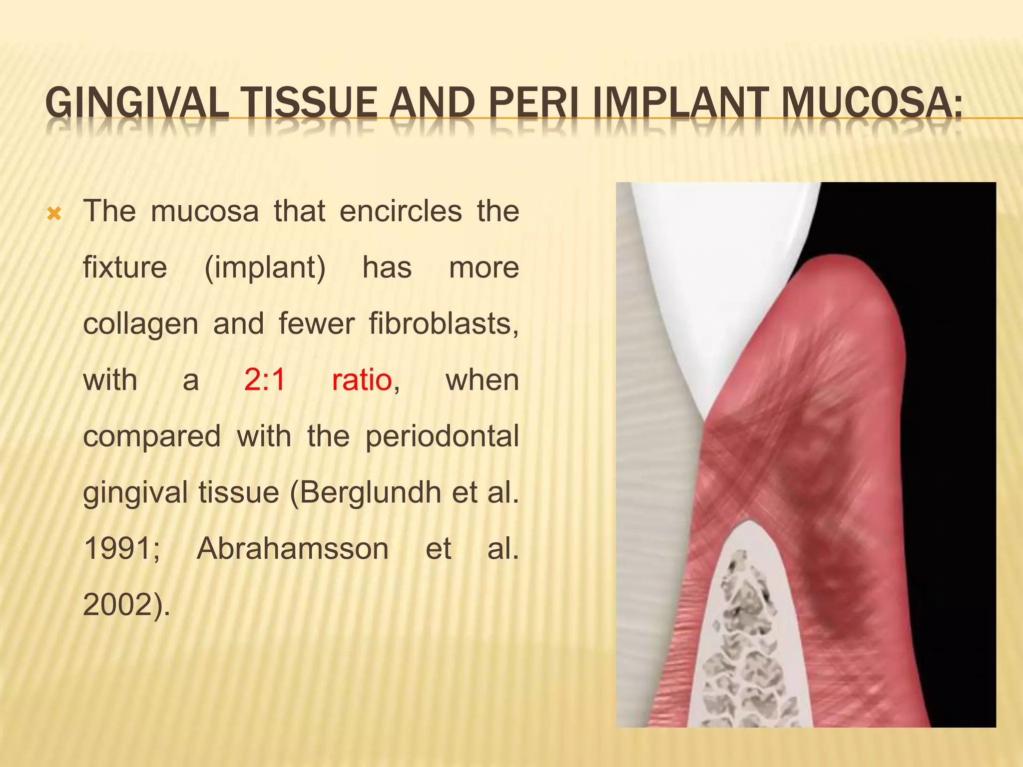 Soft tissue considerations for implant placement | PPTX