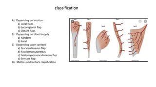 A) Depending on location
a) Local flaps
b) Locoregional flap
c) Distant flaps
B) Depending on blood supply
a) Random
b) Axial
C) Depending upon content
a) Fasciocutaneous flap
b) Fasciomyocutaneous
c) fasciomyoosseocutaneous flap
d) Sensate flap
D) Mathes and Nehai’s classification
classification
 