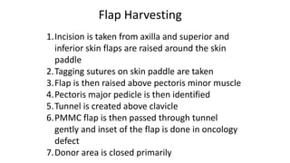 1.Incision is taken from axilla and superior and
inferior skin flaps are raised around the skin
paddle
2.Tagging sutures on skin paddle are taken
3.Flap is then raised above pectoris minor muscle
4.Pectoris major pedicle is then identified
5.Tunnel is created above clavicle
6.PMMC flap is then passed through tunnel
gently and inset of the flap is done in oncology
defect
7.Donor area is closed primarily
Flap Harvesting
 