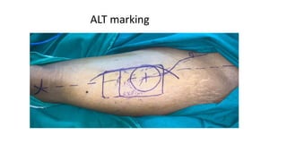 ALT marking
 