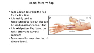 Radial forearm flap
• Yang Goufan described this flap
for the first time
• It is mainly used as
fasciocutaneous flap but also can
be used as osseocutaneous flap
• It is axial pattern flap based on
radial artery and its vena
comitans
• Mainly used for reconstruction of
tongue defects
 