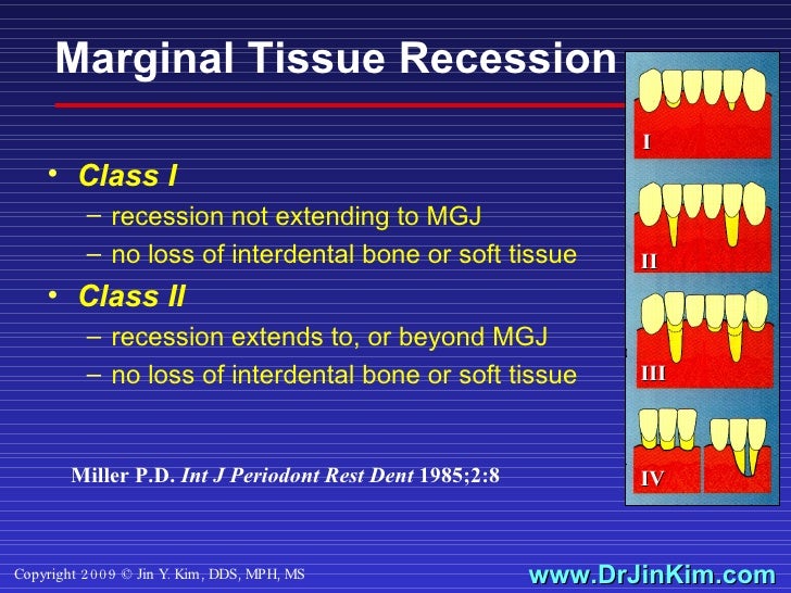 Soft Tissue Grafts Techniques