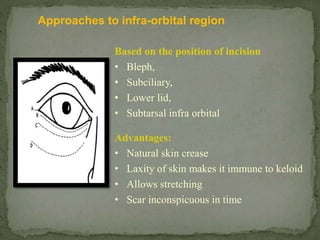 Subciliary Approach Incision Soft tissue handling in pan facial trauma | PPTX