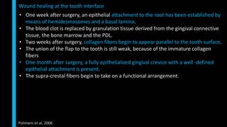 • One week after surgery, an epithelial attachment to the root has been established by
means of hemidesmosomes and a basal lamina.
• The blood clot is replaced by granulation tissue derived from the gingival connective
tissue, the bone marrow and the PDL.
• Two weeks after surgery, collagen fibers begin to appear parallel to the tooth surface.
• The union of the flap to the tooth is still weak, because of the immature collagen
fibers
• One month after surgery, a fully epithelialized gingival crevice with a well -defined
epithelial attachment is present.
• The supra-crestal fibers begin to take on a functional arrangement.
Wound healing at the tooth interface
Polimeni et al, 2006
 