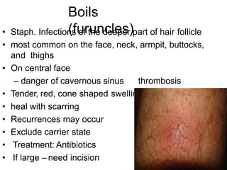 Boils
(furuncles)
• Staph. Infections of the deeper part of hair follicle
• most common on the face, neck, armpit, buttocks,
and thighs
• On central face
– danger of cavernous sinus thrombosis
• Tender, red, cone shaped swelling
• heal with scarring
• Recurrences may occur
• Exclude carrier state
• Treatment: Antibiotics
• If large – need incision
 