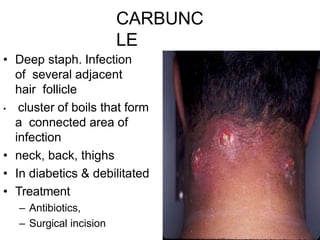 CARBUNC
LE
• Deep staph. Infection
of several adjacent
hair follicle
• cluster of boils that form
a connected area of
infection
• neck, back, thighs
• In diabetics & debilitated
• Treatment
– Antibiotics,
– Surgical incision
 