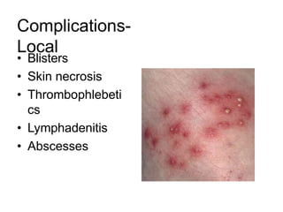 Complications-
Local
• Blisters
• Skin necrosis
• Thrombophlebeti
cs
• Lymphadenitis
• Abscesses
 
