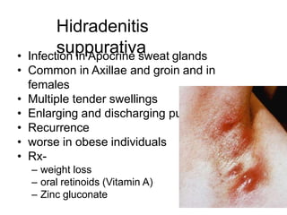 Hidradenitis
suppurativa
• Infection in Apocrine sweat glands
• Common in Axillae and groin and in
females
• Multiple tender swellings
• Enlarging and discharging pus
• Recurrence
• worse in obese individuals
• Rx-
– weight loss
– oral retinoids (Vitamin A)
– Zinc gluconate
 