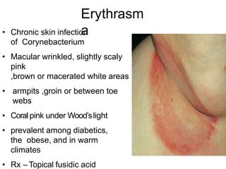 Erythrasm
a
• Chronic skin infection
of Corynebacterium
• Macular wrinkled, slightly scaly
pink
,brown or macerated white areas
• armpits ,groin or between toe
webs
• Coral pink under Wood’slight
• prevalent among diabetics,
the obese, and in warm
climates
• Rx – Topical fusidic acid
 