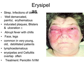 Erysipel
as
• Strep. Infections of dermis
• Well demarcated,
painful, erythematous
• indurated plaques, Blisters
& ulceration 
• Abrupt fever with chills
• Face, legs
• common in very young,
old, debilitated patients
• lymphoedematous
• erysipelas and Cellulitis
overlap often
• Treatment: Penicillin IV/IM
 