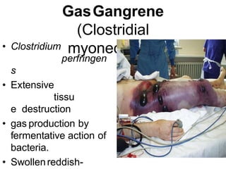 GasGangrene
(Clostridial
myonecrosis)
• Clostridium
perfringen
s
• Extensive
tissu
e destruction
• gas production by
fermentative action of
bacteria.
• Swollenreddish-
 
