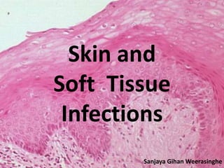 Skin and 
Soft Tissue 
Infections 
Sanjaya Gihan Weerasinghe 
 