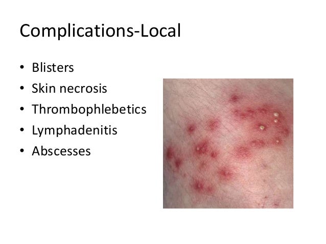 Skin And Soft Tissue Infections
