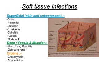 Soft tissue infections
Superficial (skin and subcutanous) :-
-Boils
-Folliculitis
-Impetigo
-Erysipelas
-Cellulitis
-Abcess
-Carbuncle
Deep ( Fascia & Muscle) :-
-Necrotizing Fasciitis
-Gas gangrene
Organs :-
-Cholecystitis
-Appendicitis
 