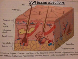 Soft tissue infections
 