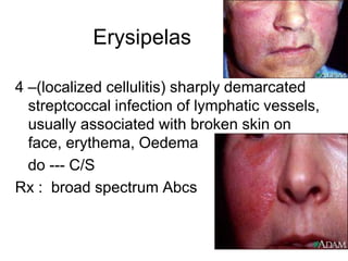 Erysipelas
4 –(localized cellulitis) sharply demarcated
streptcoccal infection of lymphatic vessels,
usually associated with broken skin on
face, erythema, Oedema
do --- C/S
Rx : broad spectrum Abcs
 