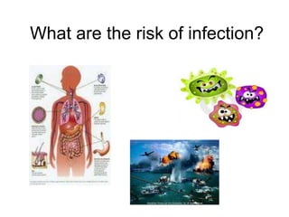 What are the risk of infection?
 