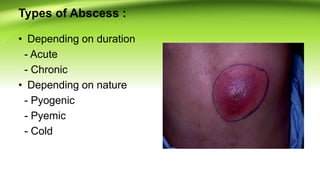 Python's Abscesses Soft tissue infections in children | PPTX