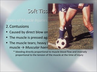 Types of Muscle Injuries
2.Contusions
• Caused by direct blow on a muscle
• The muscle is pressed against the bone
• The muscle tears; heavy bleeding* deep within
muscle → Muscular haematoma
* bleeding directly proportional to muscle blood flow and inversely
proportional to the tension of the muscle at the time of injury
Soft Tissue InjuriesSoft Tissue Injuries
 