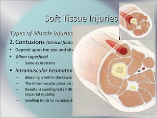 Types of Muscle InjuriesTypes of Muscle Injuries
2.Contusions (Clinical features)
• Depend upon the size and site of haematoma produced
• When superficial
– Same as in strains
• Intramuscular heamatoma
– Bleeding is within the fascia covering the muscle
– The intramuscular pressure builds up and counteract further bleeding
– Resultant swelling lasts > 48hrs, accompanied tenderness, pain,
impaired mobility
– Swelling tends to increase due to osmosis.
Soft Tissue InjuriesSoft Tissue Injuries
 