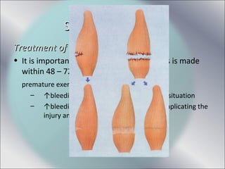 Treatment of Acute Muscle InjuryTreatment of Acute Muscle Injury
• It is important that the accurate diagnosis is made
within 48 – 72 hrs.
premature exercising
– ↑bleeding in intramuscular haematoma situation
– ↑bleeding and scar tissue formation complicating the
injury and delaying recovery
Soft Tissue InjuriesSoft Tissue Injuries
 