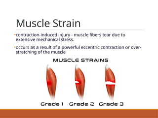 Soft tissue injuries - Muscles , ligaments and tendon injuries | PPTX