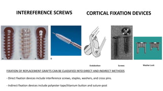 INTEREFERENCE SCREWS CORTICAL FIXATION DEVICES
FIXATION OF REPLACEMENT GRAFTS CAN BE CLASSIFIED INTO DIRECT AND INDIRECT METHODS
- Direct fixation devices include interference screws, staples, washers, and cross pins.
- Indirect fixation devices include polyester tape/titanium button and suture-post
 