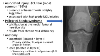 • Associated injury: ACL tear (most
common ~95%)
• presence of hemarthrosis is highly
suggestive
• associated with high grade MCL injuries
• Pellegrini-Stieda syndrome
• calcification at the medial femoral
insertion site
• results from chronic MCL deficiency
• Anatomy
• Superficial (located n layer II)
• Primary stabilizer to valgus stress (all
angles of flexion)
• Deep (located in layer III)
• Secondary stabilizer to valgus stress (full
knee extension)
 