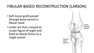 FIBULAR-BASED RECONSTRUCTION (LARSON)
• Soft tissue graft passed
through bone tunnel in
fibular head
• Limbs are then crossed to
create figure-of-eight and
fixed to lateral femur to a
single tunnel
 