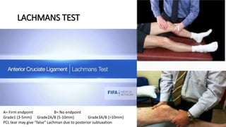 LACHMANS TEST
A= Firm endpoint B= No endpoint
Grade1 (3-5mm) Grade2A/B (5-10mm) Grade3A/B (>10mm)
PCL tear may give "false" Lachman due to posterior subluxation
 