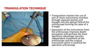 • Triangulation involves the use of
one or more instruments inserted
through separate portals and
brought into the optical field of the
arthroscope forming the apex of a
triangle
• Separation of the instruments from
the arthroscope improves depth
perception and perhaps the most
significant advantage, permits
independent movement of the
arthroscope and the surgical
instrument which is essential for
operative arthroscopy
 