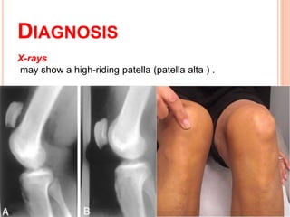 Soft tissue injury of the knee | PPTX