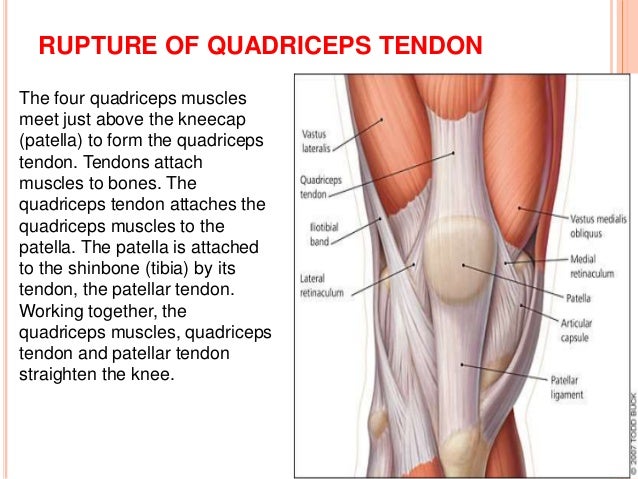 Soft tissue injury of the knee