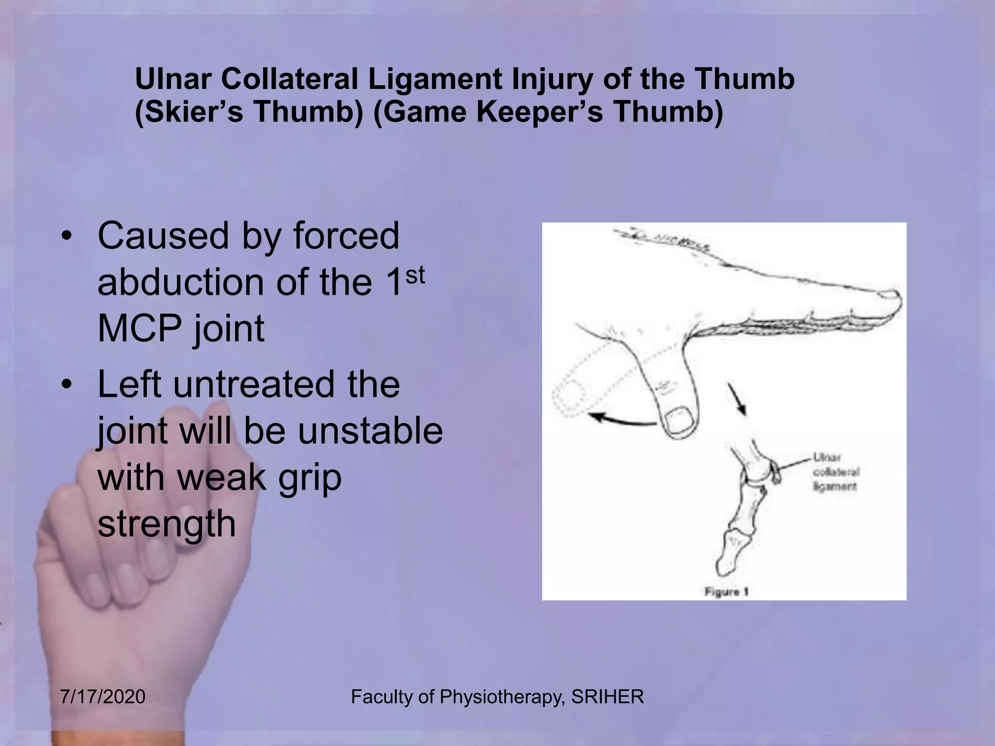 Soft tissue lesion hand | PPTX