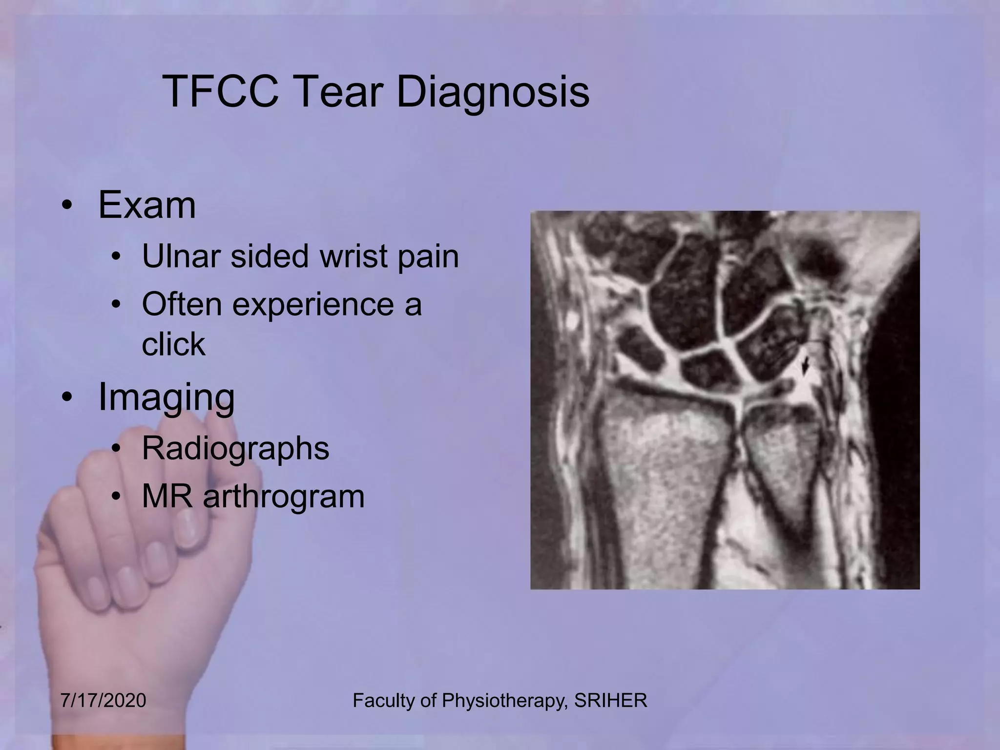 Soft tissue lesion hand | PPTX