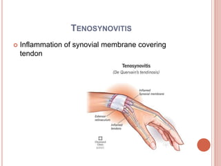 Sheathing Injury Soft tissue lesions/sprain,strian,acute injury, subacute injury ...