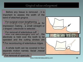88
 Before any tissue is removed , it is
important to assess the width of the
band of attached gingiva .
 To enlarge the...