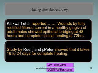 89
Healing after electrosurgery
Kalkwarf et al reported…….. Wounds by fully
rectified filtered current in a healthy gingiv...